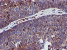 EPN2 Antibody (clone OTI1F5)