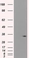 PIM2 / Pim-2 Antibody (clone OTI5B5)