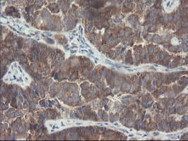 VBP1 Antibody (clone OTI1A5)