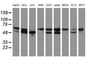 NONO / P54NRB Antibody (clone OTI2C9)