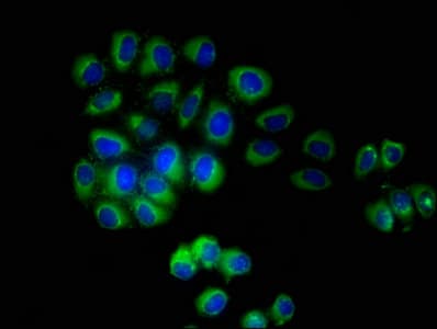 TMEM161B Antibody