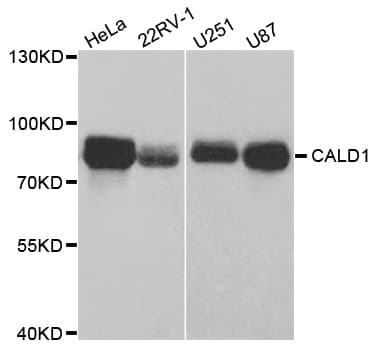 Polyclonal Rabbit anti-Human CALD1 / Caldesmon Antibody (IHC, IF, WB)