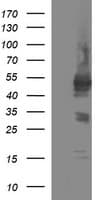 TUBB1 / Tubulin Beta 1 Antibody (clone OTI1D5)