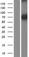 PGM5 / Aciculin Protein (Over-Expression Lysate Myc-DDK (Flag))