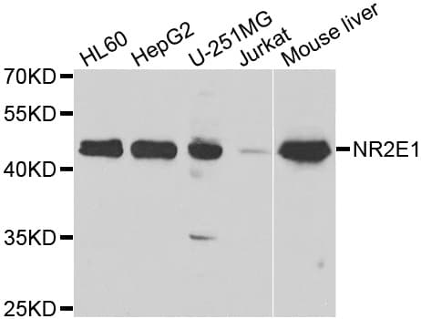 NR2E1 / TLX Antibody
