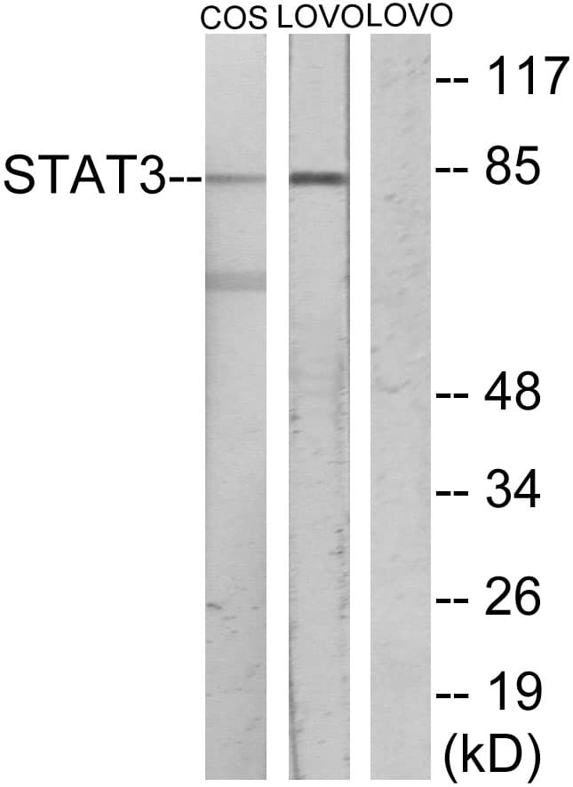 STAT3 Antibody (aa656-705)