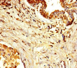 DPH7 / WDR85 Antibody