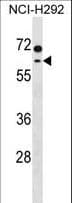 Polyclonal Rabbit anti-Human MCCC2 / MCCB Antibody (aa468-496, WB)