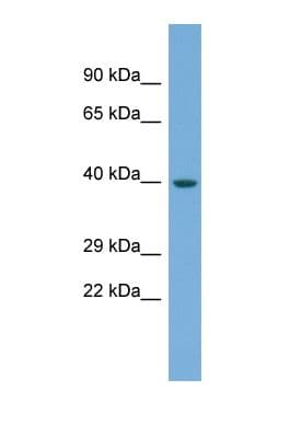ENOSF1 Antibody (aa171-220)