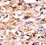 GCN2 Antibody (aa1-30)