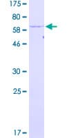 Human PSMC6 Protein (Recombinant GST)