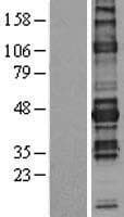 NFATC1 / NFAT2 Protein (Over-Expression Lysate Myc-DDK (Flag))