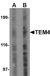 IHC-plus™ ARHGEF17 / TEM4 Antibody