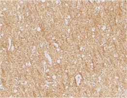 ANTXR1 / TEM8 Antibody