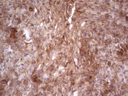 LAMA4 / Laminin Alpha 4 Antibody (aa25-270, clone OTI5G8)
