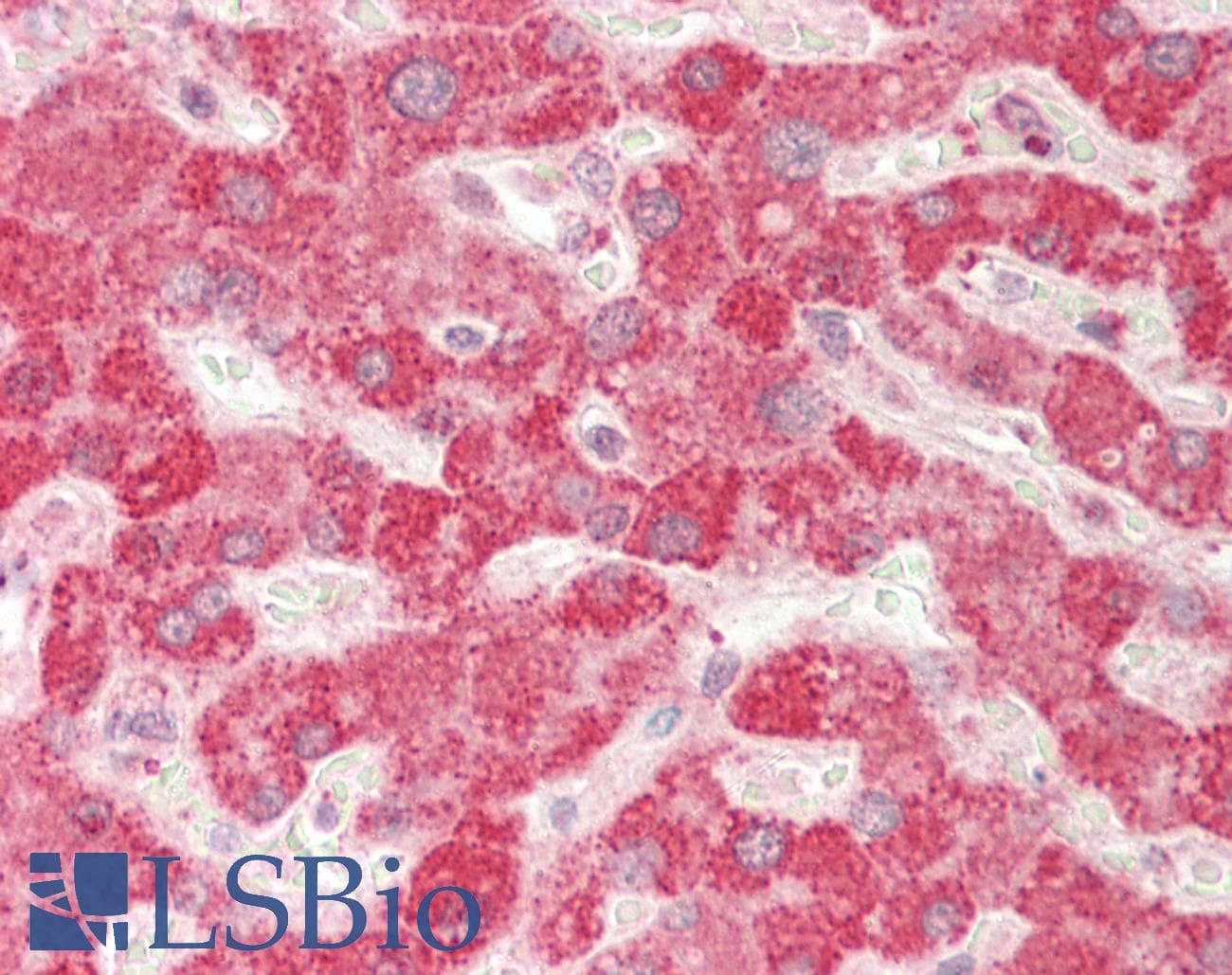 Junctophilin 2 / JPH2 Antibody (aa66-115)