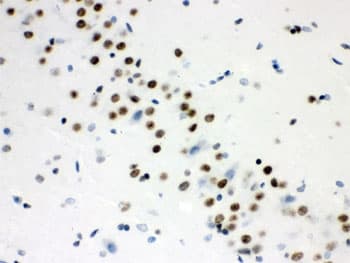 WNT2B Antibody