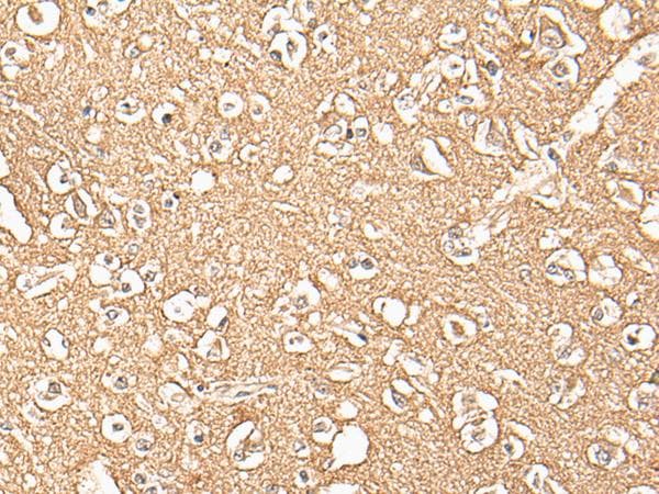 Polyclonal Rabbit anti-Human ADORA3 / Adenosine A3 Receptor Antibody (IHC, WB)