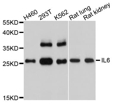 IL6 / Interleukin 6 Antibody