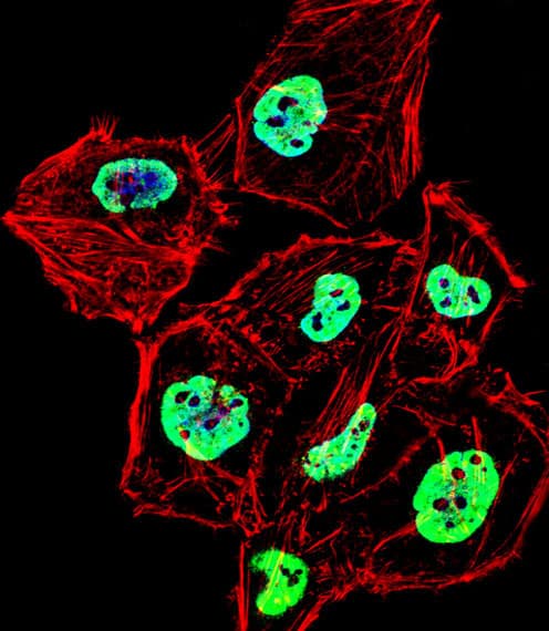 Polyclonal Rabbit anti-Human HNRNPD / AUF1 Antibody (aa57-85, IF, WB)