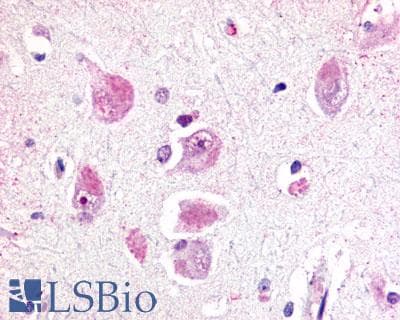 PathPlus™ RXFP3 Antibody (Cytoplasmic Domain)
