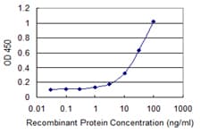 IHC-plus™ HEDLS / EDC4 Antibody (clone 2E2)