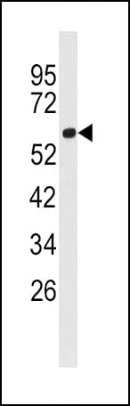 Polyclonal Rabbit anti-Human ACSL3 Antibody (aa1-30, IHC, WB)