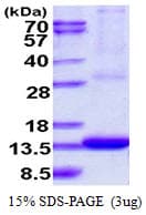 Human ARL9 Protein (Recombinant His)