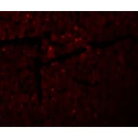 IHC-plus™ Polyclonal Rabbit anti-Human DDA1 Antibody (IHC, IF, WB)