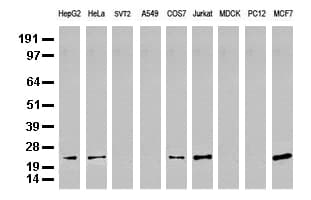 Monoclonal Mouse anti-Human MGMT Antibody (clone UMAB56, Carrier-free, IHC, IF, WB)