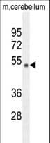 Polyclonal Rabbit anti-Human WDR41 Antibody (aa249-277, WB)