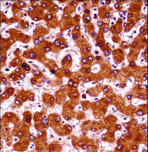 E4 / UBE4A Antibody (aa451-479)