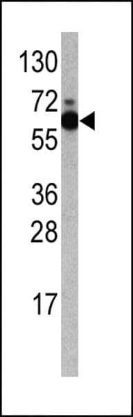 RPS6KB1 / P70S6K / S6K Antibody (aa277-306)