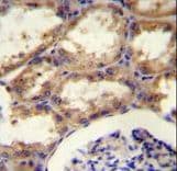 Polyclonal Rabbit anti-Human MAFK Antibody (aa57-85, IHC, WB)