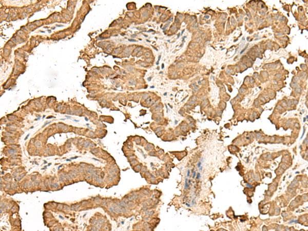 RPS25 / Ribosomal Protein S25 Antibody