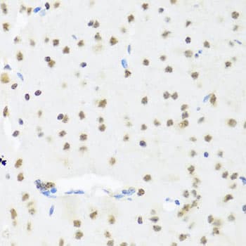 Polyclonal Rabbit anti-Human SET / TAF-I Antibody (IHC, WB)