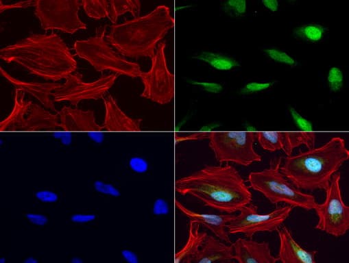 MGMT Antibody (clone UMAB56)