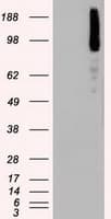 BRAF / B-Raf Antibody (clone OTI5A9)