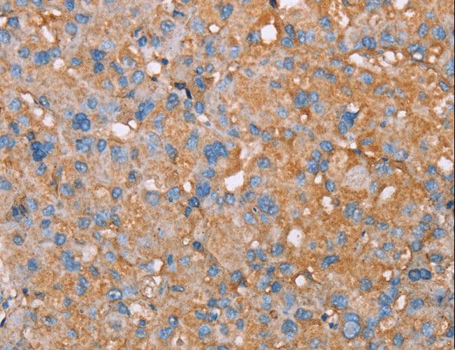 Polyclonal Rabbit anti-Human PAGE5 Antibody (IHC)