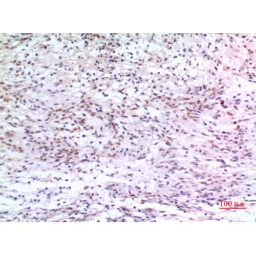 ZNF307 Antibody (Internal)