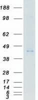Human MYLK4 Protein (Recombinant Myc-DDK (Flag))