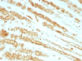 Pan Cytokeratin Antibody (clone KRTL/1077 + KRTH/1076)