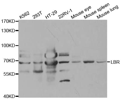 LBR / Lamin B Receptor Antibody