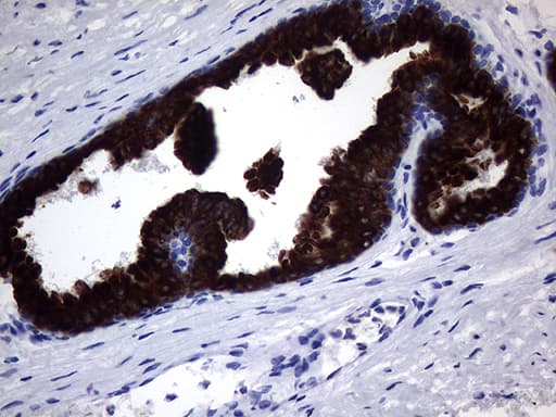 KRT18 / CK18 / Cytokeratin 18 Antibody (aa69-372, clone OTI10G8)
