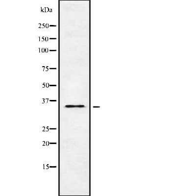 OR5H6 Antibody