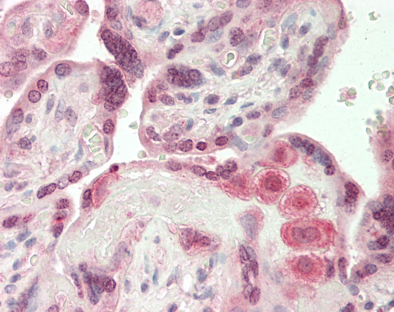 Polyclonal Rabbit anti-Human LAMC1 / Laminin Gamma 1 Antibody (aa1404-1453, IHC, WB)