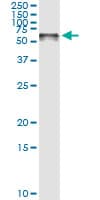 Monoclonal Mouse anti-Human STI1 / STIP1 Antibody (clone 4B6, IF, WB)