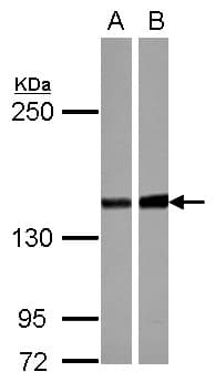 Polyclonal Rabbit anti-Human PPP2R3A / PR130 Antibody (C-Terminus, IHC, WB)