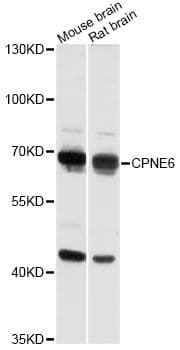 Polyclonal Rabbit anti-Human CPNE6 / N-COPINE Antibody (WB)