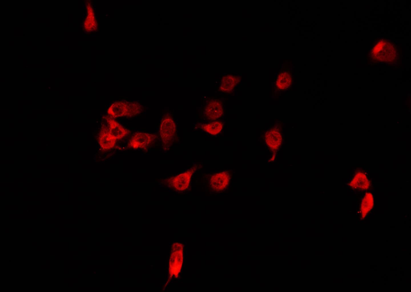 Polyclonal Rabbit anti-Human IRX2 Antibody (IHC, IF, WB)